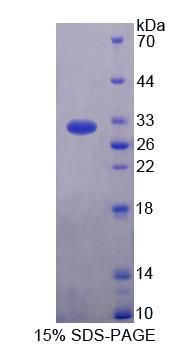 Rhotekin蛋白(RTKN)重組蛋白,Recombinant Rhotekin (RTKN)