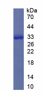 Rho关联含卷曲螺旋结合蛋白激酶1(Rock1)重组蛋白,Recombinant Rho Associated Coiled Coil Containing Protein Kinase 1 (Rock1)