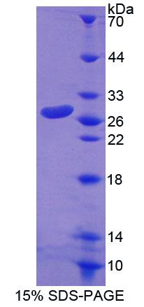 Rho家族GTP酶1(RND1)重组蛋白,Recombinant Rho Family GTPase 1 (RND1)