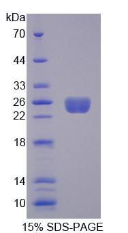 Rho鸟嘌呤核苷酸交换因子7(ARHGEF7)重组蛋白,Recombinant Rho Guanine Nucleotide Exchange Factor 7 (ARHGEF7)