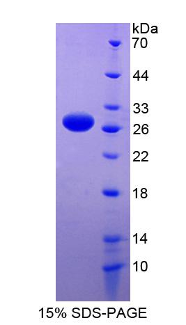 RNA結(jié)合基元蛋白38(RBM38)重組蛋白,Recombinant RNA Binding Motif Protein 38 (RBM38)