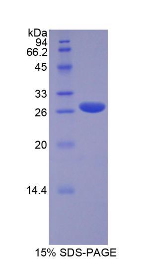 Runt相关转录因子2(RUNX2)重组蛋白,Recombinant Runt Related Transcription Factor 2 (RUNX2)