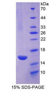 R-脊椎蛋白1(RSPO1)重组蛋白,Recombinant R-Spondin 1 (RSPO1)