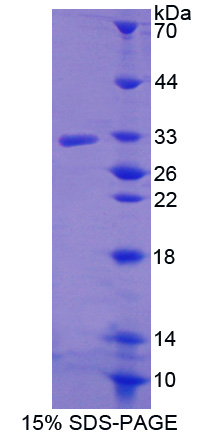 R-脊椎蛋白3(RSPO3)重组蛋白,Recombinant R-Spondin 3 (RSPO3)