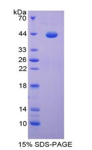 S100鈣結(jié)合蛋白(S100)重組蛋白,Recombinant S100 Calcium Binding Protein (S100)