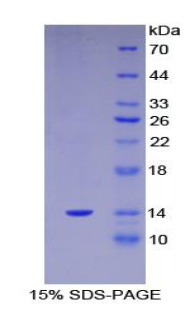 S100钙结合蛋白A11(S100A11)重组蛋白,Recombinant S100 Calcium Binding Protein A11 (S100A11)