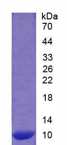 S100钙结合蛋白A12(S100A12)重组蛋白,Recombinant S100 Calcium Binding Protein A12 (S100A12)