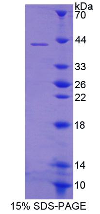 S100钙结合蛋白A14(S100A14)重组蛋白,Recombinant S100 Calcium Binding Protein A14 (S100A14)