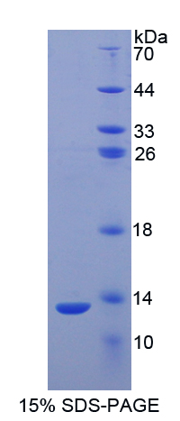 S100鈣結(jié)合蛋白A2(S100A2)重組蛋白,Recombinant S100 Calcium Binding Protein A2 (S100A2)