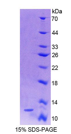 S100钙结合蛋白A4(S100A4)重组蛋白,Recombinant S100 Calcium Binding Protein A4 (S100A4)