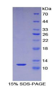 S100钙结合蛋白A5(S100A5)重组蛋白,Recombinant S100 Calcium Binding Protein A5 (S100A5)