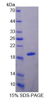 S100钙结合蛋白A8(S100A8)重组蛋白,Recombinant S100 Calcium Binding Protein A8 (S100A8)