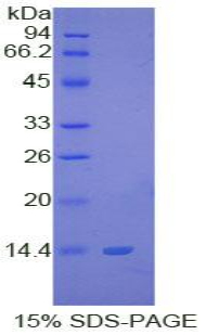 S100钙结合蛋白B(S100B)重组蛋白,Recombinant S100 Calcium Binding Protein B (S100B)