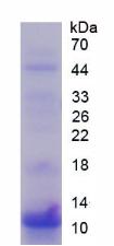 S100钙结合蛋白P(S100P)重组蛋白,Recombinant S100 Calcium Binding Protein P (S100P)