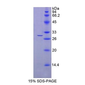 N-酰基乙醇氨酸酰化酶(NAAA)重组蛋白,Recombinant N-Acylethanolamine Acid Amidase (NAAA)