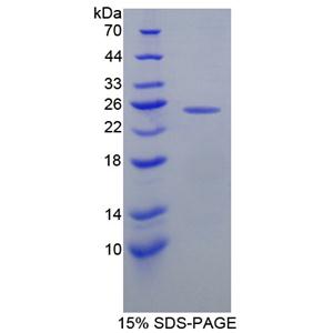 O-6-甲基鸟嘌呤DNA甲基转移酶(MGMT)重组蛋白