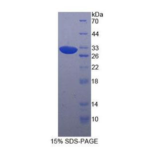 p21蛋白激活激酶4(PAK4)重组蛋白