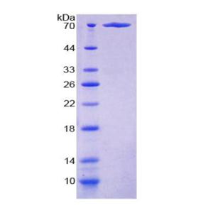 PP2A癌症抑制抑制因子(CIP2A)重组蛋白