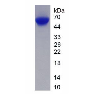 RAD23同源物B(RAD23B)重组蛋白