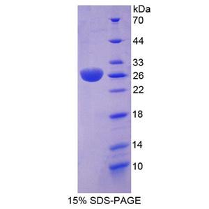 RAS癌基因家族成员RAB37(RAB37)重组蛋白