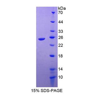 Ras相關(guān)C3肉毒菌毒素底物1(Rac1)重組蛋白,Recombinant Ras Related C3 Botulinum Toxin Substrate 1 (Rac1)