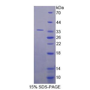 Ras抑制蛋白1(RSU1)重組蛋白