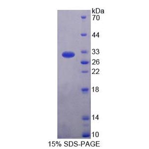 Rhotekin蛋白(RTKN)重組蛋白,Recombinant Rhotekin (RTKN)