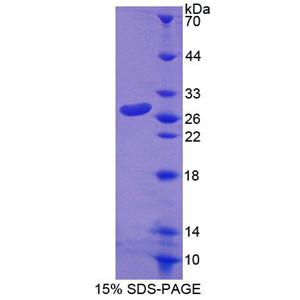 Rho家族GTP酶1(RND1)重组蛋白