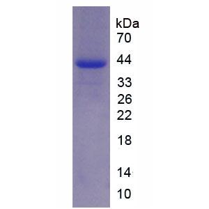 Rh血型D抗原(RHD)重组蛋白