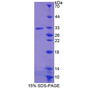 R-脊椎蛋白3(RSPO3)重组蛋白