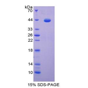 S100钙结合蛋白(S100)重组蛋白