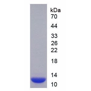S100钙结合蛋白A10(S100A10)重组蛋白