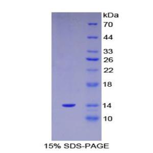 S100钙结合蛋白A11(S100A11)重组蛋白,Recombinant S100 Calcium Binding Protein A11 (S100A11)