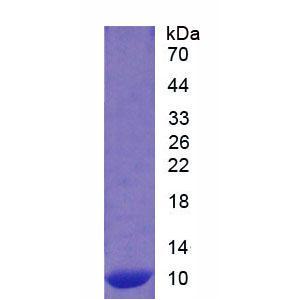 S100钙结合蛋白A12(S100A12)重组蛋白