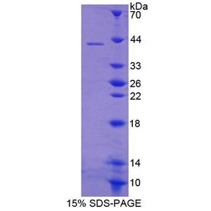 S100钙结合蛋白A14(S100A14)重组蛋白,Recombinant S100 Calcium Binding Protein A14 (S100A14)