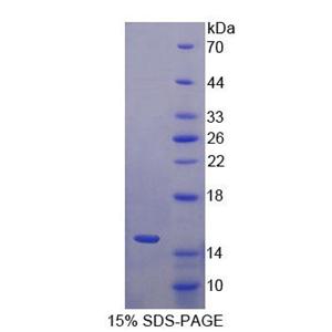 S100钙结合蛋白A15(S100A15)重组蛋白