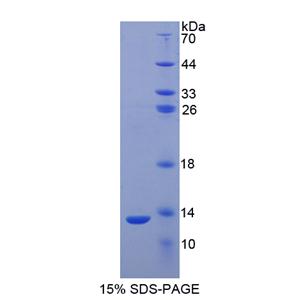 S100钙结合蛋白A2(S100A2)重组蛋白
