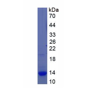 S100钙结合蛋白A3(S100A3)重组蛋白