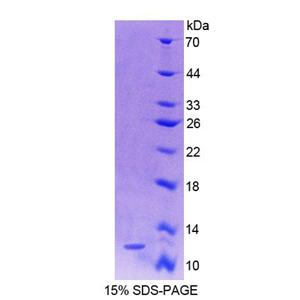 S100钙结合蛋白A4(S100A4)重组蛋白