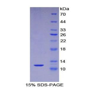 S100钙结合蛋白A5(S100A5)重组蛋白
