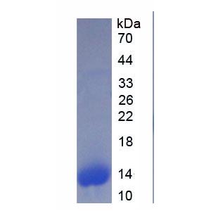 S100钙结合蛋白A6(S100A6)重组蛋白