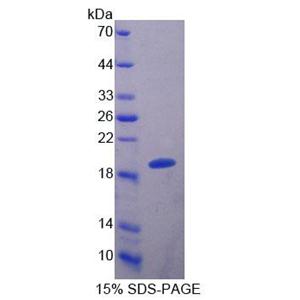 S100钙结合蛋白A8(S100A8)重组蛋白