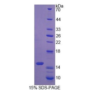 S100钙结合蛋白A9(S100A9)重组蛋白