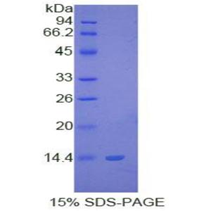 S100钙结合蛋白B(S100B)重组蛋白
