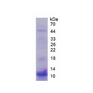 S100钙结合蛋白P(S100P)重组蛋白