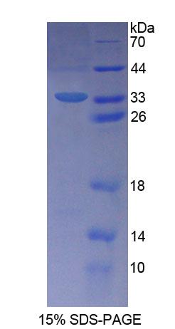 Schlafen家族成員5(SLFN5)重組蛋白,Recombinant Schlafen Family Member 5 (SLFN5)