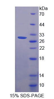 SCO细胞色素氧化酶缺陷同源物2(SCO2)重组蛋白,Recombinant SCO Cytochrome Oxidase Deficient Homolog 2 (SCO2)