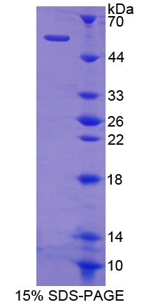 SHC-转化蛋白3(SHC3)重组蛋白,Recombinant SHC-Transforming Protein 3 (SHC3)