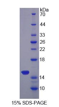 Sideroflexin 1蛋白(SFXN1)重组蛋白,Recombinant Sideroflexin 1 (SFXN1)