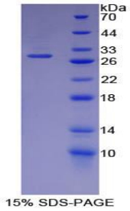 Smad同源物4(Smad4)重組蛋白,Recombinant Mothers Against Decapentaplegic Homolog 4 (Smad4)